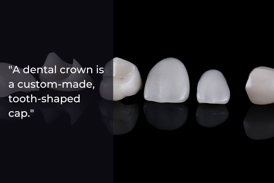 Five dental crowns of different shapes and sizes are displayed on a reflective black surface next to a text definition about how dental crowns protect damaged teeth and help strengthen teeth.