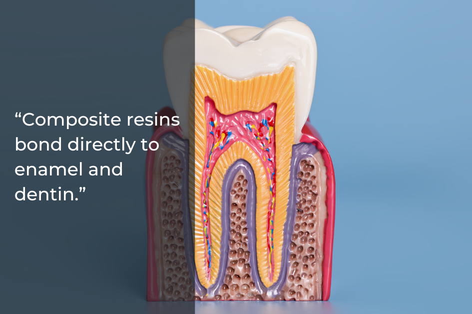 Cross-section model of a human tooth showing enamel, dentin, and inner structures with text stating tooth-colored fillings bond directly to enamel and dentin for a natural-looking result.