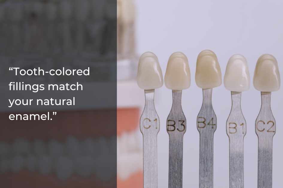 Five tooth-colored dental shade guides are displayed in front of a blurred dental model, illustrating the range available for natural-looking fillings and matching tooth-colored fillings.